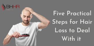 Five Practical Steps for Hair Loss to Deal With it Hair loss